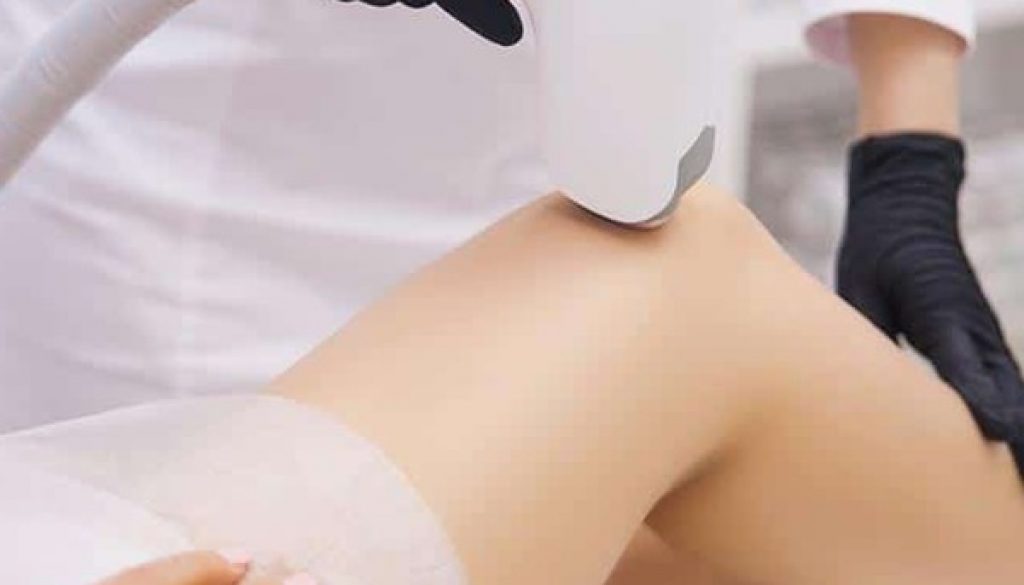 Laser-Hair-Removal-Crouch-End Laser-Hair-Removal-Crouch-End