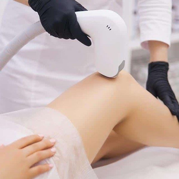 Laser-Hair-Removal-Crouch-End